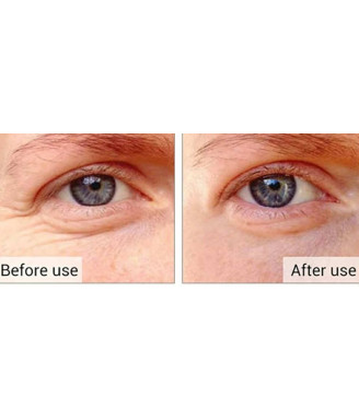 HYALURONIC ACID HYDROGEL EYEPATCH Хидрогелни пачове с високо съдържание на хиалуронова киселина